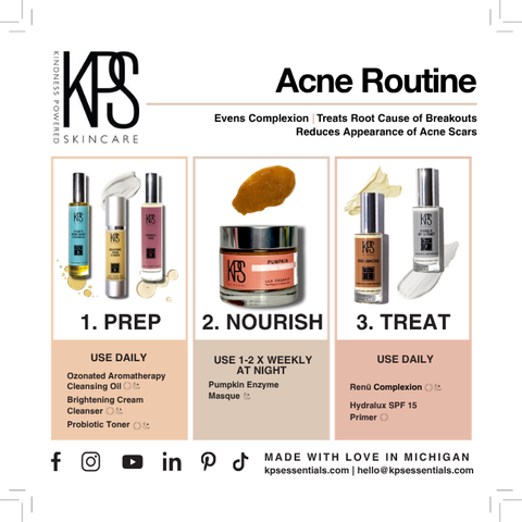 Acne Routine