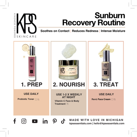 Sunburn Recovery Routine