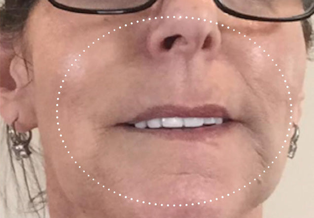 After three weeks of at-home treatment with KPS Essentials