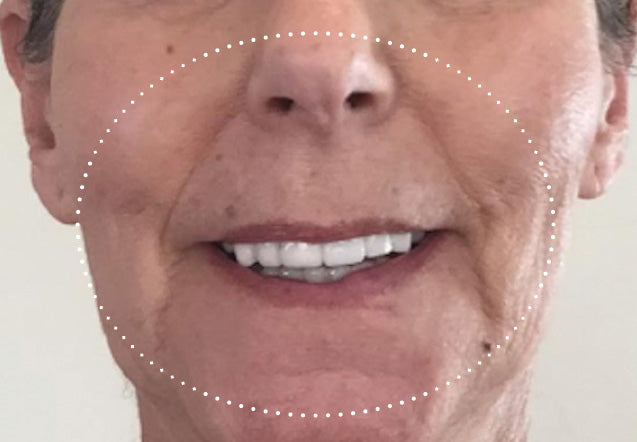 Before three weeks of at-home treatment with KPS Essentials