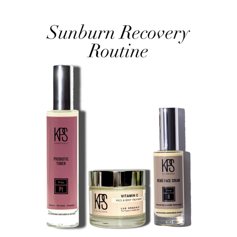 Sunburn Recovery Routine